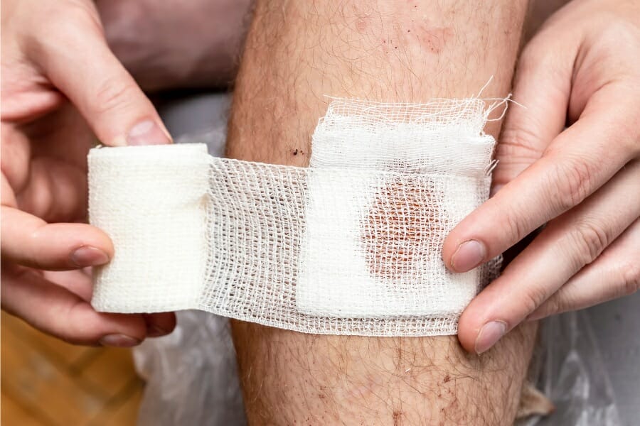 nurse addressing a wound