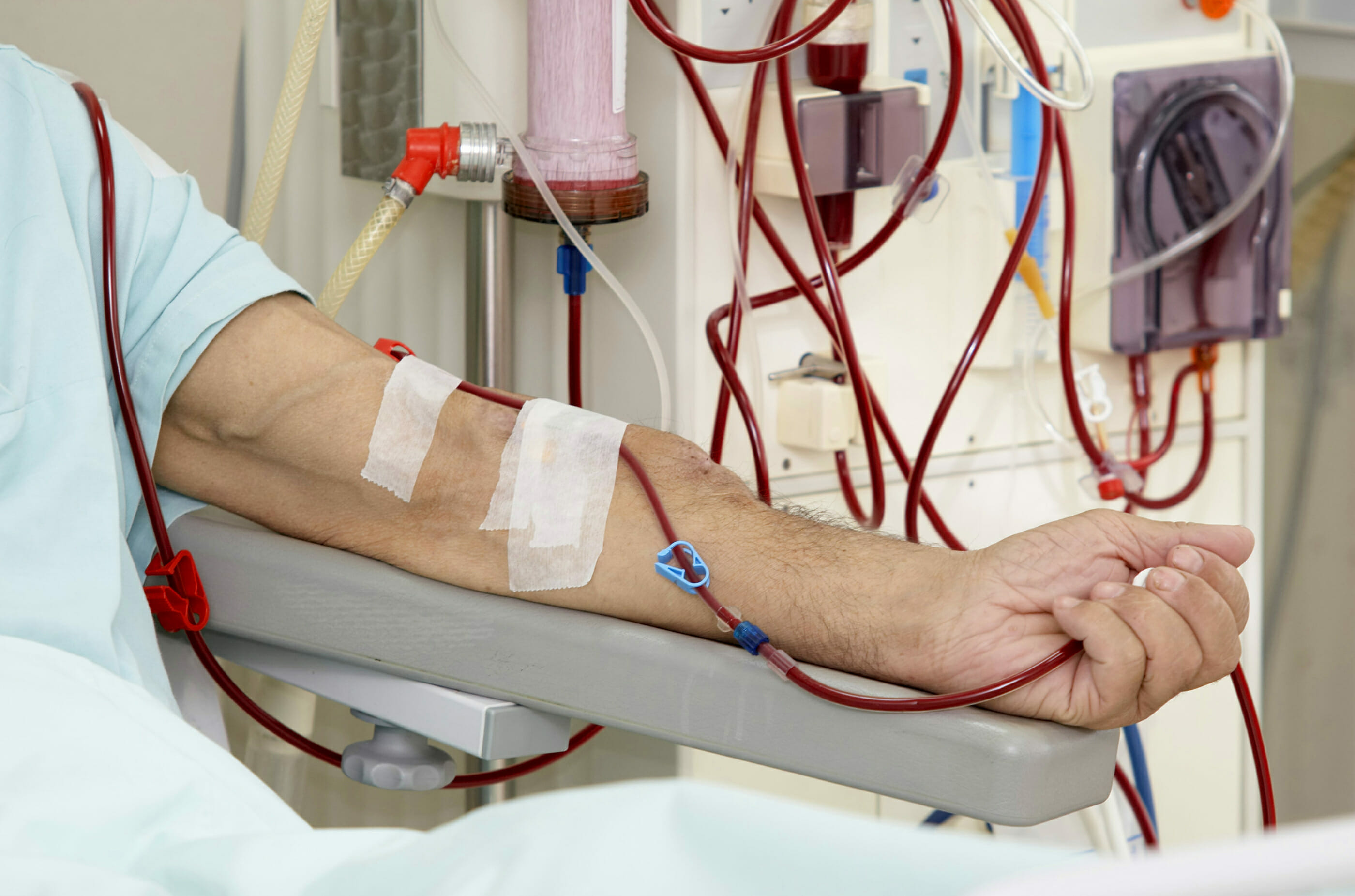 dialysis-for-kidney-disease