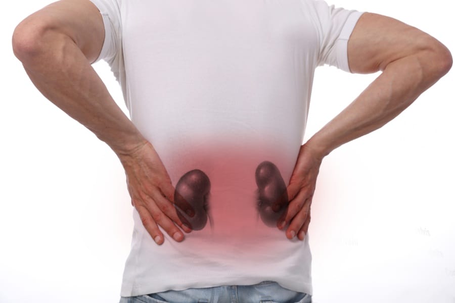 A diagram showing an individual having kidney pain
