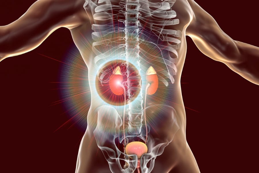 a diagram displaying kidney disease