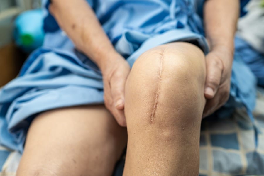 A patient who had knee surgery