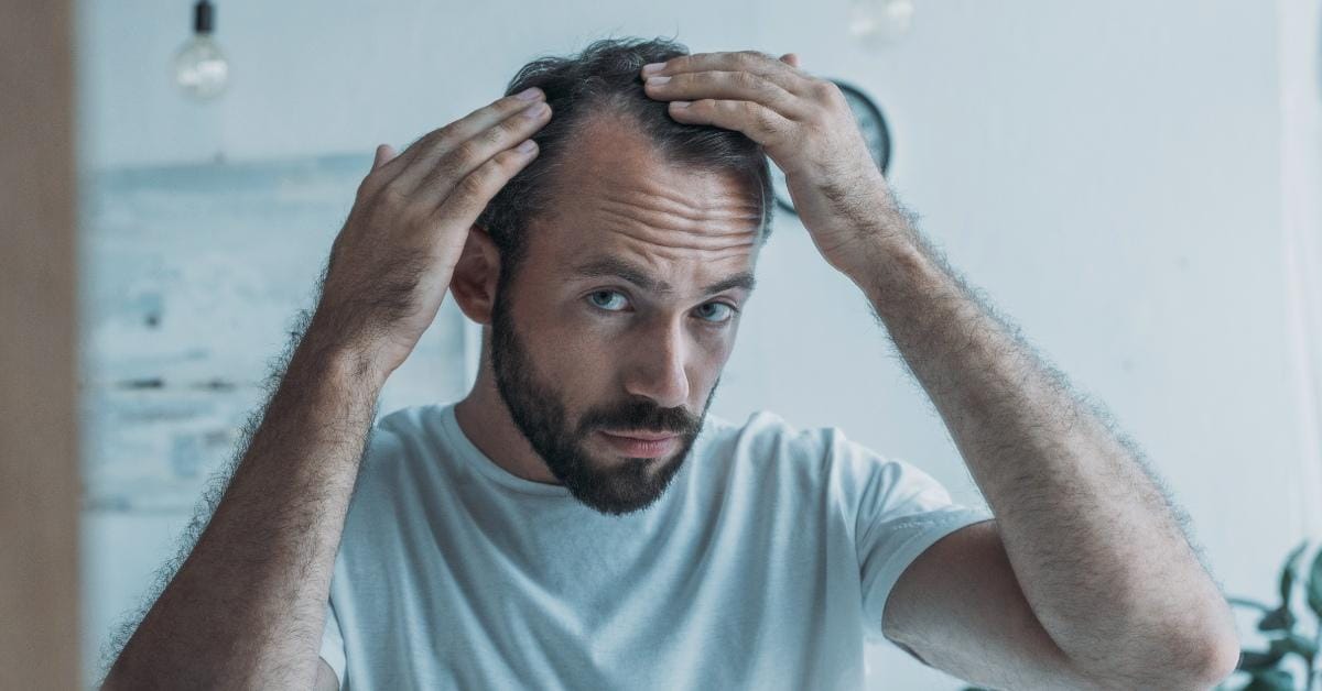 man with MS going bald