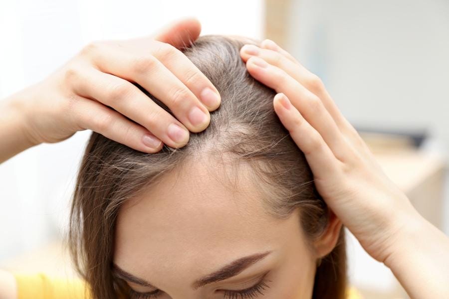 woman with multiple sclerosis checking to see if she is experiencing hair loss