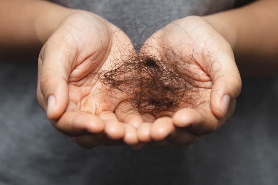 does multiple sclerosis cause hair loss