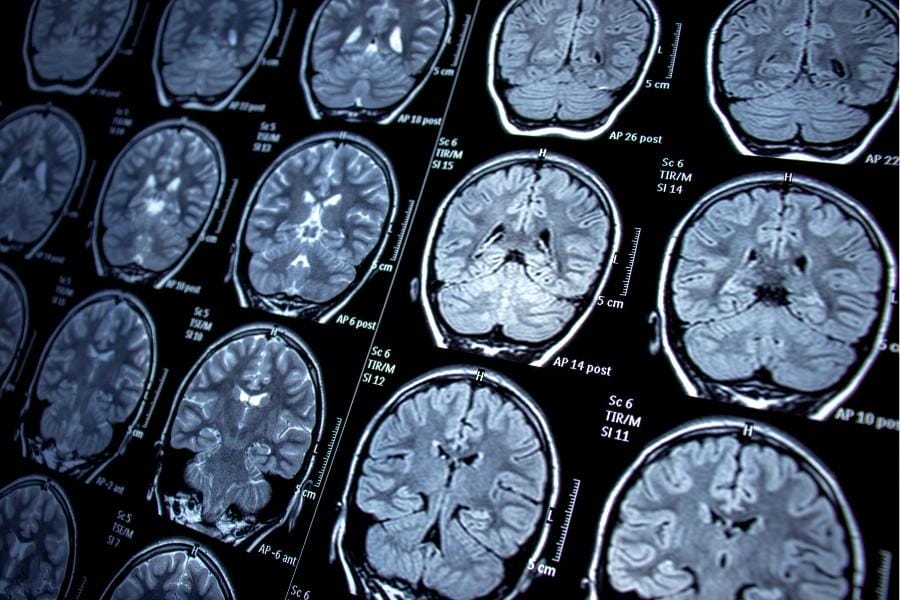 Brain scans