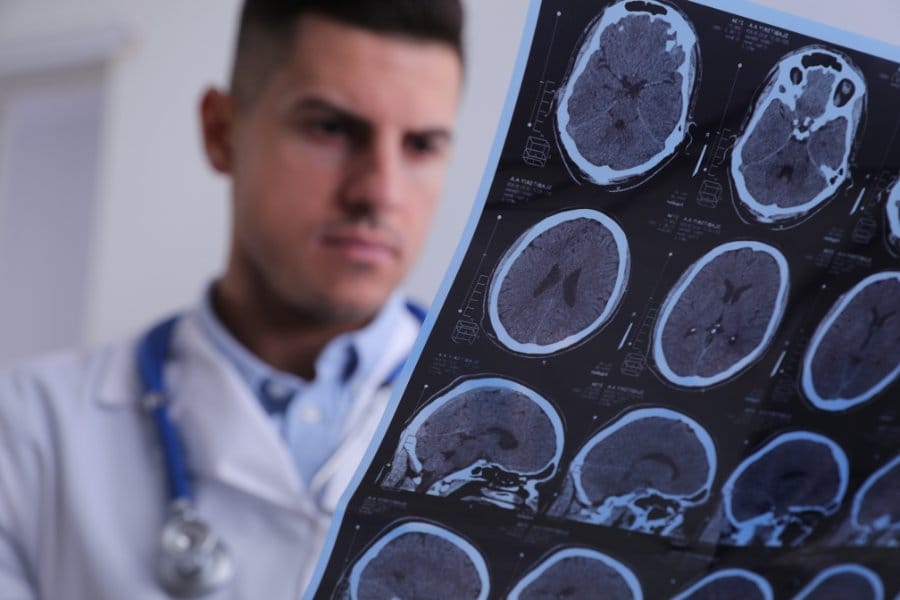 Multiple sclerosis diagnosis