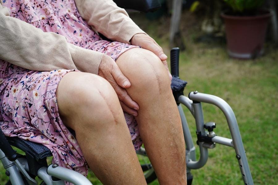 after surgery recovery care in menlo park A client in a wheel chair who had knee surgery