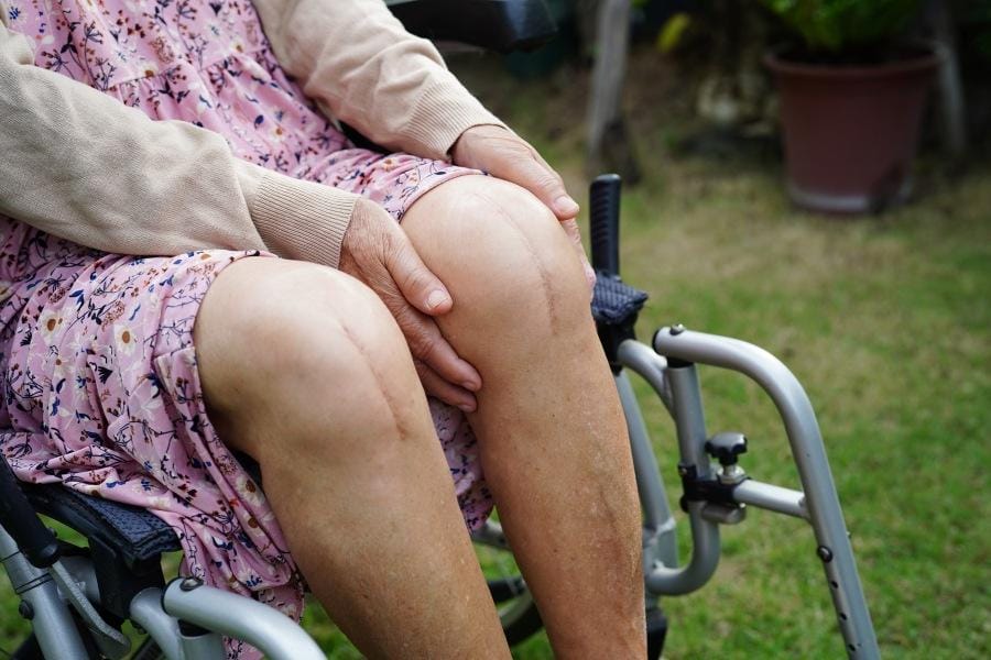 Elderly woman in a wheelchair after knee replacement surgery
