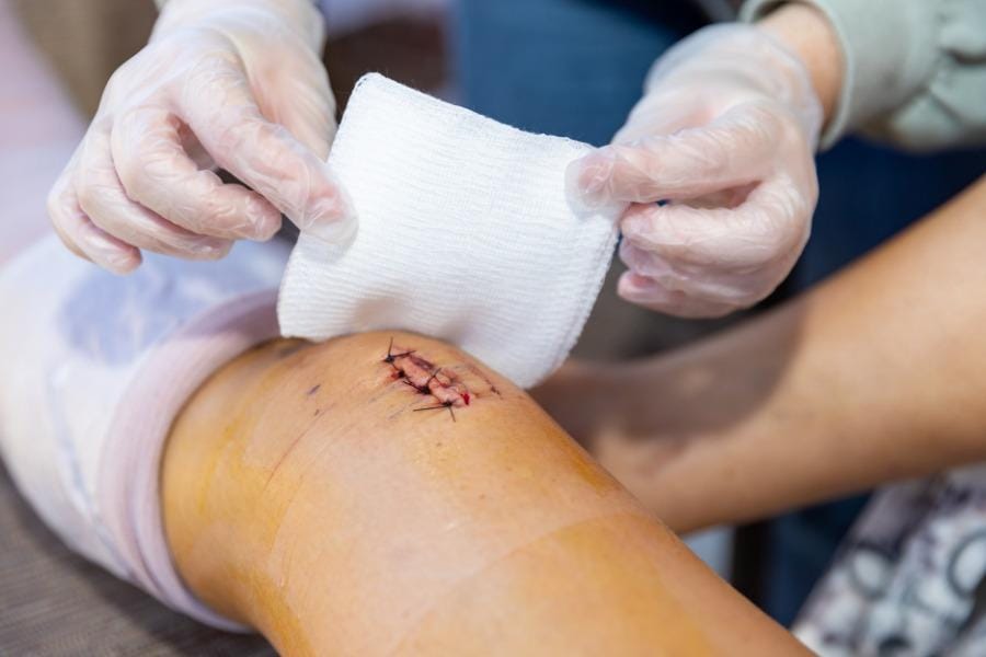 surgical recovery nurse Chino Hills Home RN treating a wound on the knee